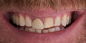 Before Treatment Photo
