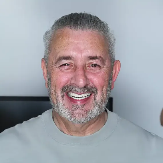 Dental Implant Patient Photo
